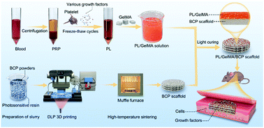 Graphical abstract: A 3D-printed biphasic calcium phosphate scaffold loaded with platelet lysate/gelatin methacrylate to promote vascularization