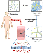 Graphical abstract: Freezing-triggered gelation of quaternized chitosan reinforced with microfibrillated cellulose for highly efficient removal of bilirubin