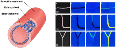 Graphical abstract: Tissue-engineered vascular graft based on a bioresorbable tubular knit scaffold with flexibility, durability, and suturability for implantation