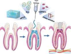Graphical abstract: Fabrication of an exosome-loaded thermosensitive chitin-based hydrogel for dental pulp regeneration