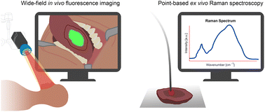 Graphical abstract: Development of a near-infrared Raman spectroscopy setup compatible with fluorescence-guided surgery