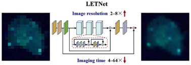 Graphical abstract: Acceleration of high-quality Raman imaging via a locality enhanced transformer network