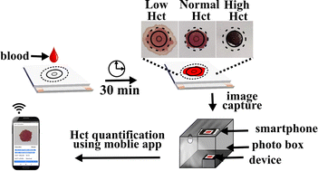 Graphical abstract: A smartphone-integrated low-cost, reagent-free, non-destructive dried blood spot-based paper sensor for hematocrit measurement