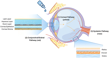 Graphical abstract: Nano-based ocular drug delivery systems: an insight into the preclinical/clinical studies and their potential in the treatment of posterior ocular diseases