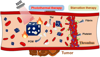 Graphical abstract: Photothermal-responsive Prussian blue nanocages loaded with thrombin for tumor starvation therapy and photothermal therapy