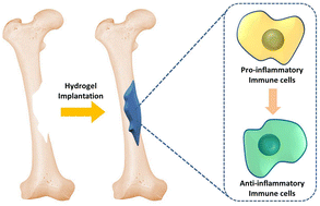 Graphical abstract: Immune homeostasis modulation by hydrogel-guided delivery systems: a tool for accelerated bone regeneration