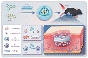 Graphical abstract: Drug delivery nanoparticles for preventing implant bacterial infections based on the bacteria and immunity mechanisms