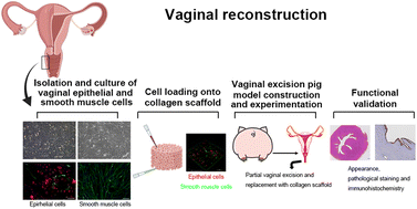 Graphical abstract: Vaginal reconstruction by collagen scaffolds loaded with vaginal epithelial and smooth muscle cells in pigs