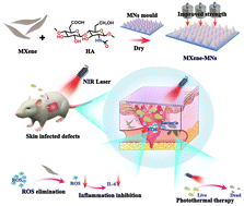 Graphical abstract: Multifunctional MXene-doped photothermal microneedles for drug-resistant bacteria-infected wound healing