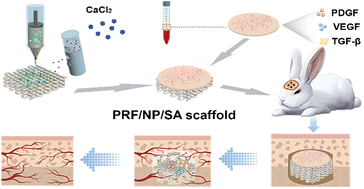 Graphical abstract: 3D printing nacre powder/sodium alginate scaffold loaded with PRF promotes bone tissue repair and regeneration