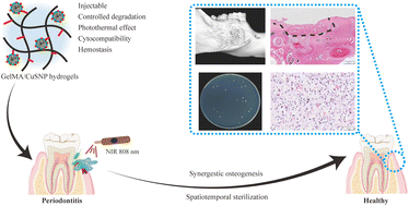 Graphical abstract: Injectable hydrogels activated with copper sulfide nanoparticles for enhancing spatiotemporal sterilization and osteogenesis in periodontal therapy