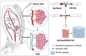 Graphical abstract: Thermoresponsive hydrogel for transcatheter arterial chemoembolization of hepatocellular carcinoma