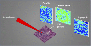 Graphical abstract: Difficulties and artefacts in cryo-fixation of ovarian tissues for X-ray fluorescence analyses