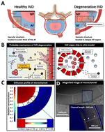 Graphical abstract: Intervertebral disc organ-on-a-chip: an innovative model to study monocyte extravasation during nucleus pulposus degeneration