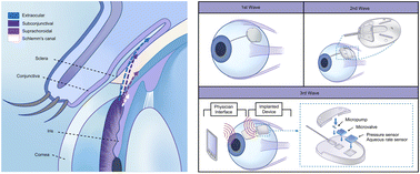 Graphical abstract: Microfluidics in the eye: a review of glaucoma implants from an engineering perspective