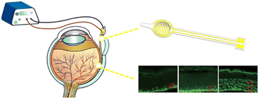 Graphical abstract: A flexible electrode Array for genetic transfection of different layers of the retina by electroporation