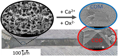 Graphical abstract: Confining calcium oxalate crystal growth in a carbonated apatite-coated microfluidic channel to better understand the role of Randall's plaque in kidney stone formation