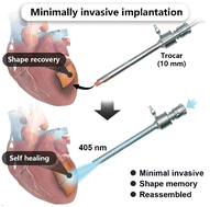 Graphical abstract: In vivo self-assembled shape-memory polyurethane for minimally invasive delivery and therapy