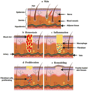 Graphical abstract: Research progress related to thermosensitive hydrogel dressings in wound healing: a review
