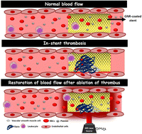Graphical abstract: Nanogold-coated stent facilitated non-invasive photothermal ablation of stent thrombosis and restoration of blood flow