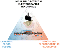 Graphical abstract: Concurrent functional ultrasound imaging with graphene-based DC-coupled electrophysiology as a platform to study slow brain signals and cerebral blood flow under control and pathophysiological brain states
