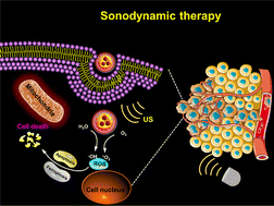Graphical abstract: A high performance AIE-active sonosensitizer for efficient sonodynamic tumor therapy