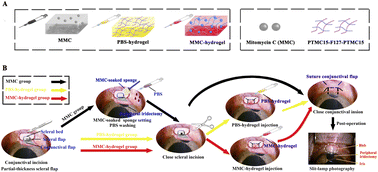 Graphical abstract: Mitomycin C-loaded PTMC15–F127–PTMC15 hydrogel maintained better bleb function after filtering glaucoma surgery in monkeys with intraocular hypertension