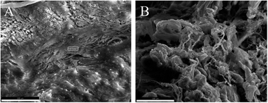 Graphical abstract: Examination of annulus fibrosus and nucleus pulposus in cervical and lumbar intervertebral disc herniation patients by scanning acoustic microscopy, scanning electron microscopy and energy dispersive spectroscopy