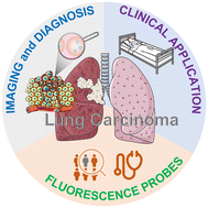 Graphical abstract: Fluorescence probes for lung carcinoma diagnosis and clinical application