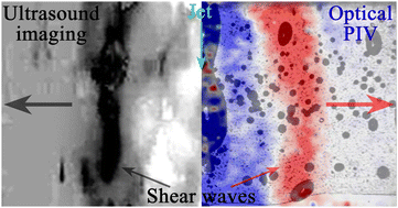 Graphical abstract: High-speed ultrasound imaging of bubbly flows and shear waves in soft matter