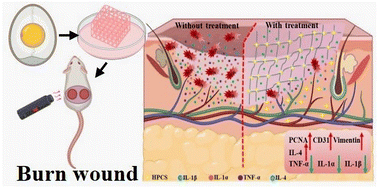 Graphical abstract: Facile synthesis of hydroxypropyl chitosan-egg white hydrogel dressing with antibacterial and antioxidative activities for accelerating the healing of burn wounds