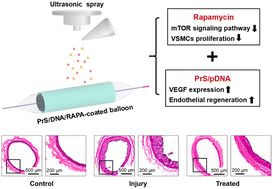 Graphical abstract: A pDNA/rapamycin nanocomposite coating on interventional balloons for inhibiting neointimal hyperplasia
