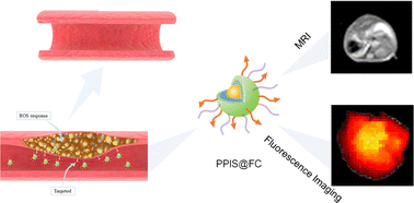 Graphical abstract: Dual-modality probe nanodrug delivery systems with ROS-sensitivity for atherosclerosis diagnosis and therapy
