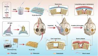 Graphical abstract: Development of a rapid-shaping and user-friendly membrane with long-lasting space maintenance for guided bone regeneration