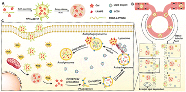 Graphical abstract: ROS-responsive curcumin-encapsulated nanoparticles for AKI therapy via promoting lipid degradation in renal tubules