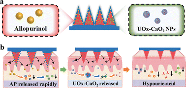 Graphical abstract: Core–shell structured microneedles with programmed drug release functions for prolonged hyperuricemia management