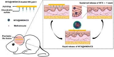 Graphical abstract: Microneedle-assisted percutaneous delivery of methotrexate-loaded nanoparticles enabling sustained anti-inflammatory effects in psoriasis therapy