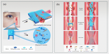 Graphical abstract: Two-electron oxidized polyphenol chemistry-inspired superhydrophilic drug-carrying coatings for the construction of multifunctional nasolacrimal duct stents