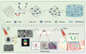 Graphical abstract: Near-infrared light-actuated on-demand botanicals release and hyperthermia by an antibiotic-free polysaccharide-based hydrogel dressing for the synergistic treatment of wound infections