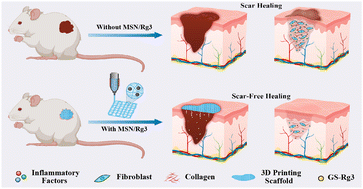 Graphical abstract: 3D printing of Rg3-loaded hydrogel scaffolds: anti-inflammatory and scar-formation related collagen inhibitory effects for scar-free wound healing