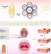 Graphical abstract: A double-layer thin oral film for wet oral mucosa adhesion and efficient treatment of oral ulcers