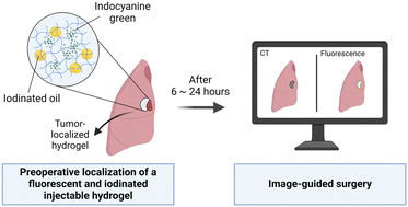 Graphical abstract: An injectable fluorescent and iodinated hydrogel for preoperative localization and dual image-guided surgery of pulmonary nodules