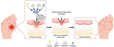 Graphical abstract: Multifunctional antibacterial hydrogels for chronic wound management