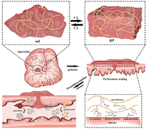Graphical abstract: A thermally reversible injectable adhesive for intestinal tissue repair and anti-postoperative adhesion