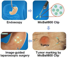 Graphical abstract: MicBall800-coated metal clip as a novel fluorescent marker for image-guided laparoscopic surgery