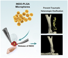 Graphical abstract: Localized and sustained delivery of indomethacin using poly(lactic-co-glycolic acid)-based microspheres to prevent traumatic heterotopic ossification