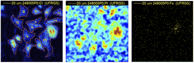 Graphical abstract: Micro-PIXE reveals cisplatin uptake followed by Fe accumulation in U87 cells