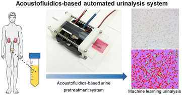 Graphical abstract: Acoustofluidic-based microscopic examination for automated and point-of-care urinalysis