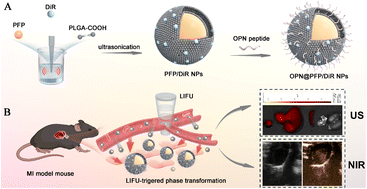 Graphical abstract: A non-invasive osteopontin-targeted phase changeable fluorescent nanoprobe for molecular imaging of myocardial fibrosis