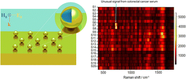 Graphical abstract: Fano enhancement of SERS for rapid early diagnosis of colorectal cancer